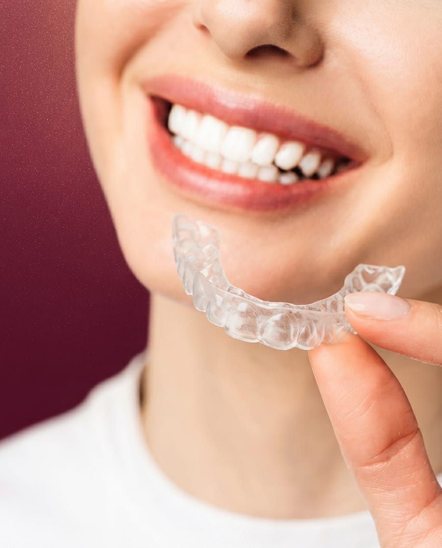 Clear aligner shown at Ooi Dan Rakan