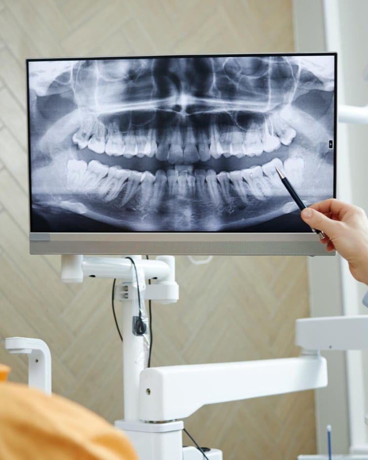 Digital dental X-ray shown on screen at Ooi Dan Rakan