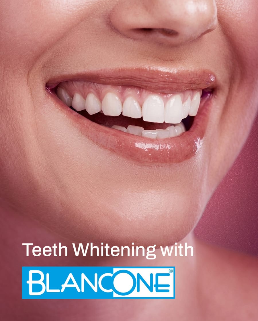 Close-up of a dentist checking a patient's tooth shade at Ooi Dan Rakan